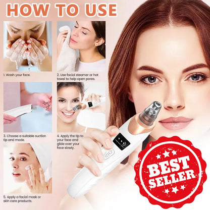 Blackhead Remover Vacuum Kit